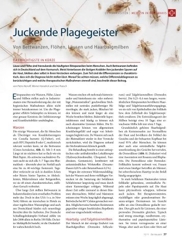 Juckende Plagegeister