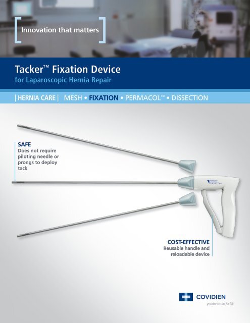 Tacker Fixation Device
