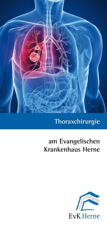 Download - EvK Herne