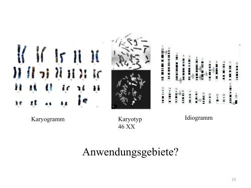 Chromosom