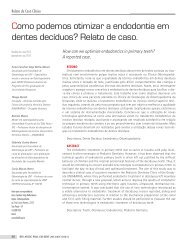 Relato de caso. - Rev@Odonto