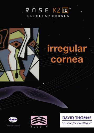 irregular cornea - David Thomas Contact Lenses