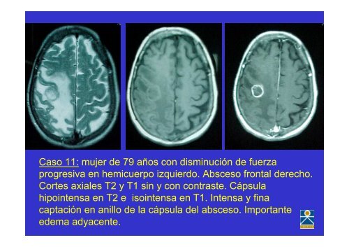 RESULTADOS: