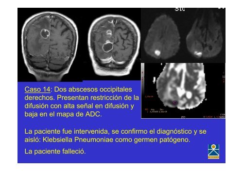 RESULTADOS: