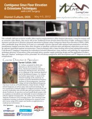 Contiguous Sinus Floor Elevation & Osteotome ... - Osteogenics