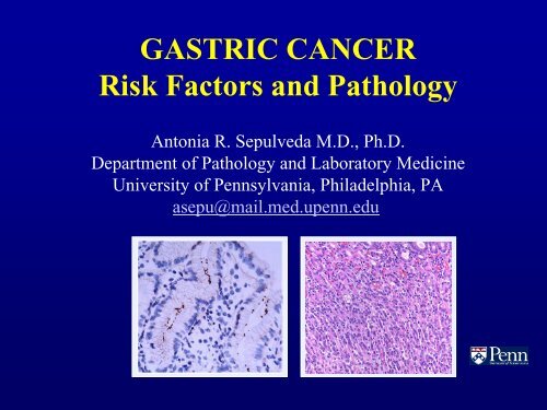 GASTRIC CANCER Risk Factors And Pathology