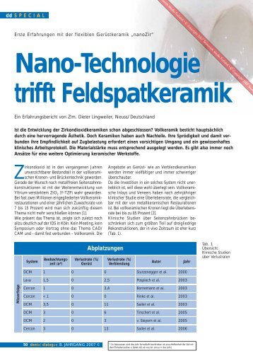 Nano-Technologie trifft Feldspatkeramik - SHOFU Dental GmbH