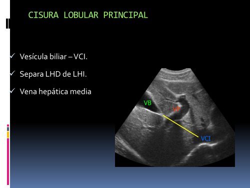 Lhi higado