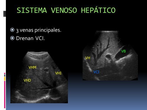 ANATOMÍA RADIOLÓGICA DEL HÍGADO