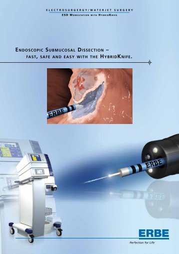 ESD Brochure (PDF 881.5 KB) - ERBE Elektromedizin GmbH