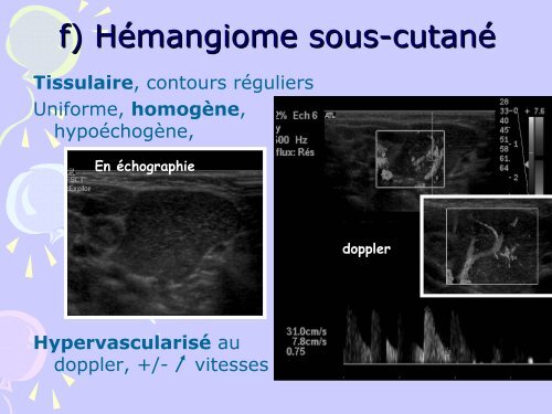 MASSES CERVICALES de l' ENFANT