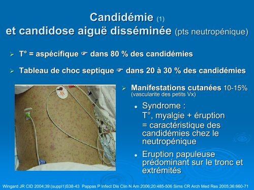 Candida