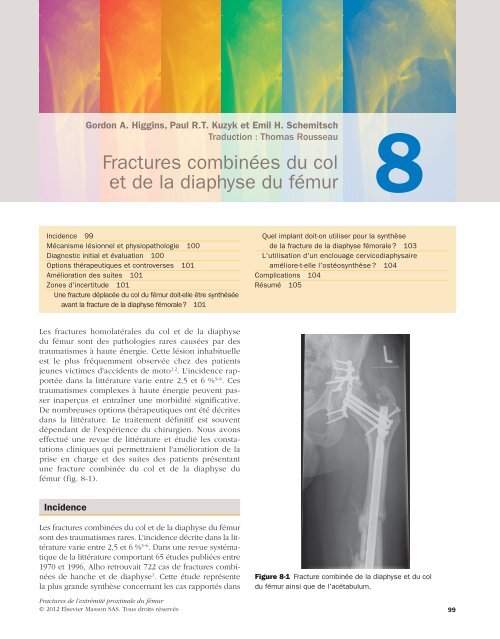 Fractures combinÃ©es du col et de la diaphyse du fÃ©mur - Decitre