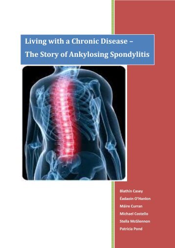 Living with a Chronic Disease â The Story of Ankylosing Spondylitis