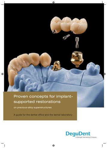 Proven concepts for implant- supported restorations - DeguDent