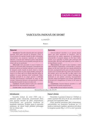 Vasculita indusa de efort