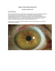 Superior Limbic Keratoconjunctivitis