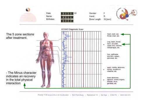 Parallel Acupuncture makes a difference - Hugo Nielsen Instituttet