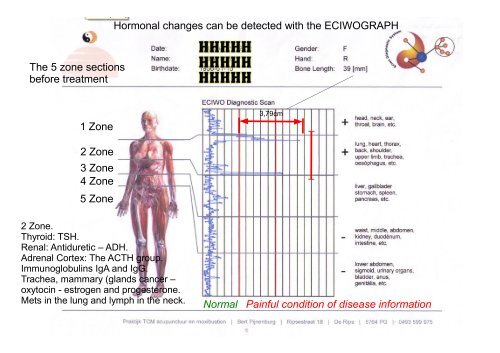 Parallel Acupuncture makes a difference - Hugo Nielsen Instituttet