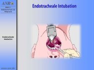 Endotracheale Intubation - Bak-24.de