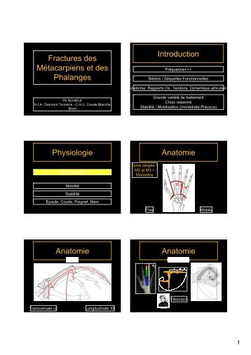 Fracture de phalanges et mÃ©tacarpiens - Rhumatologie-bichat.com