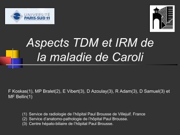 Aspects TDM et IRM de la maladie de Caroli