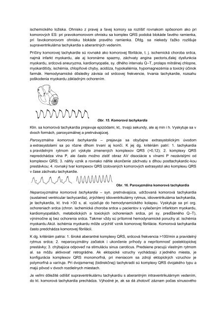 a|rytmia – [g - datasolution.sk