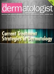 PDF] Allergic Contact Dermatitis of the Foot after use of Mastisol® Skin  Adhesive: A Case Report