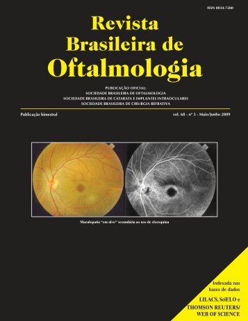 Mai-Jun - Sociedade Brasileira de Oftalmologia