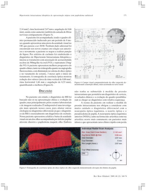 Mai-Jun - Sociedade Brasileira de Oftalmologia