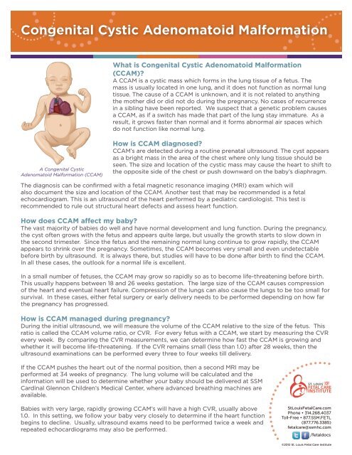 Congenital Cystic Adenomatoid Malformation - SSM Cardinal ...