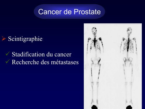 Imagerie en urologie: conduite Ã  tenir devant une image kystique