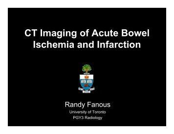 CT Imaging of Acute Bowel Ischemia and Infarction - Department of ...