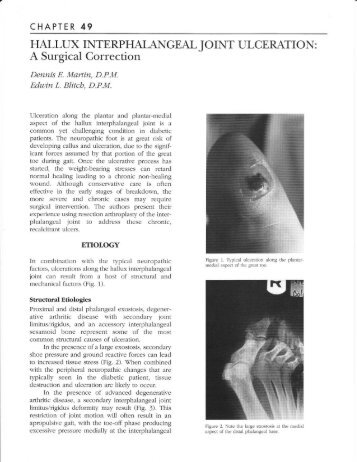 Hallux Interphalangeal Joint Ulceration - The Podiatry Institute