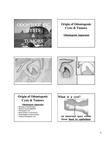 Origin of Odontogenic Cysts & Tumors Origin of Odontogenic Cysts