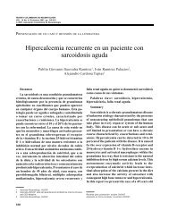 Hipercalcemia recurrente en un paciente con sarcoidosis aguda