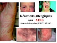 RÃ©actions allergiques aux AINS - CHUV
