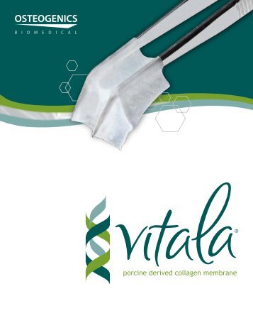 Vitala® Product Brochure - Osteogenics