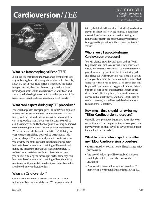 Cardioversion/TEE - Stormont-Vail HealthCare