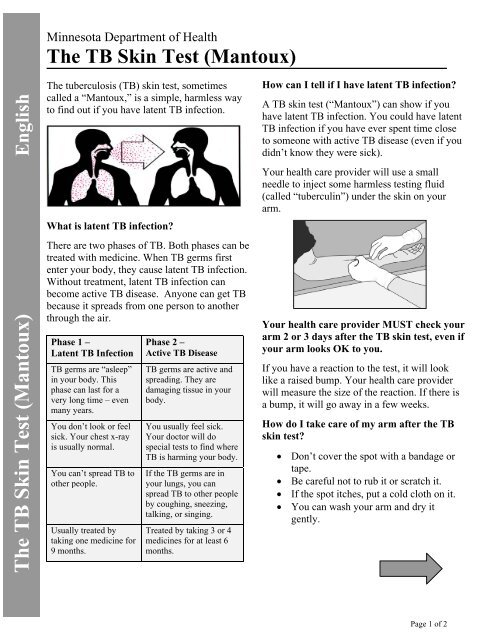 The Tb Skin Test Mantoux A Minnesota Dept Of The Exchange The Tb Skin Test Mantoux A Minnesota Dept Of The Exchange