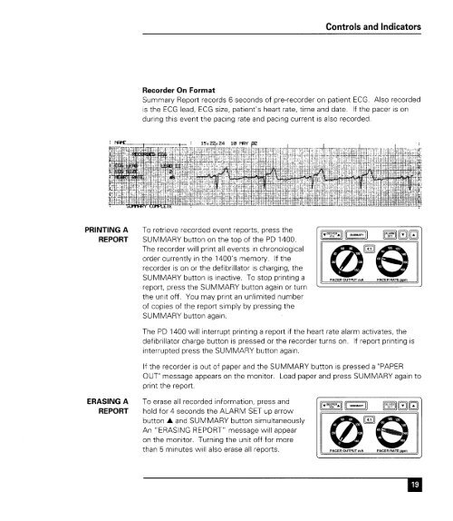 Zoll 1400 Operators Manual