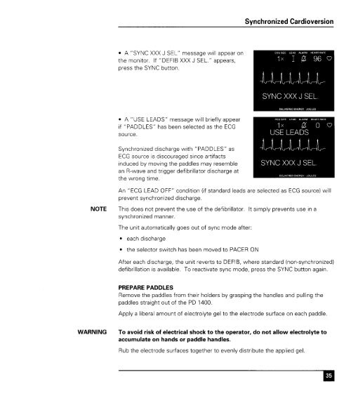 Zoll 1400 Operators Manual