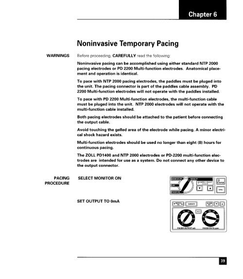 Zoll 1400 Operators Manual