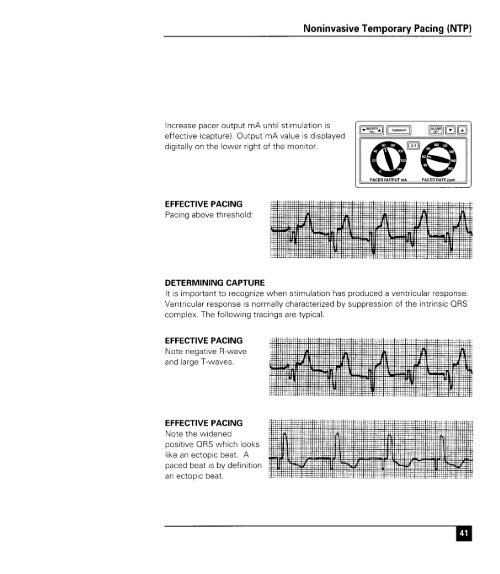 Zoll 1400 Operators Manual