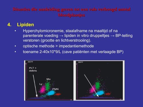 Automatische telling van bloedplaatjes - UZ Leuven