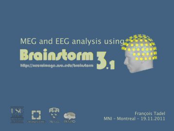 MEG source reconstruction with Brainstorm - Canada MEG ...