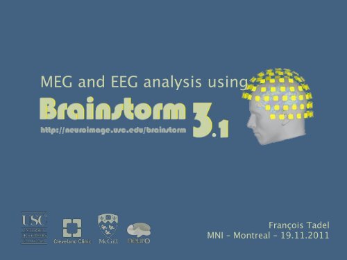 MEG source reconstruction with Brainstorm - Canada MEG ...