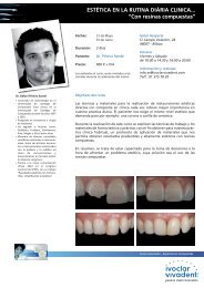 Curso Composite Rafael PiÃ±eiro Bilbao - Ivoclar Vivadent