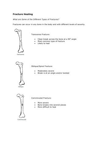 Types of Fractures - MedSource LLC