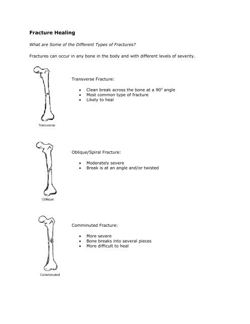 Types of Fractures - MedSource LLC